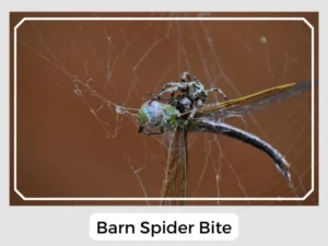 Barn Spider Bite