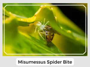 Misumessus Spider Bite