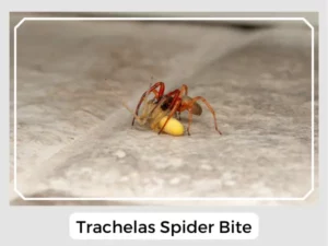 Trachelas Spider Bite