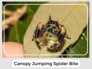 Canopy Jumping Spider Bite